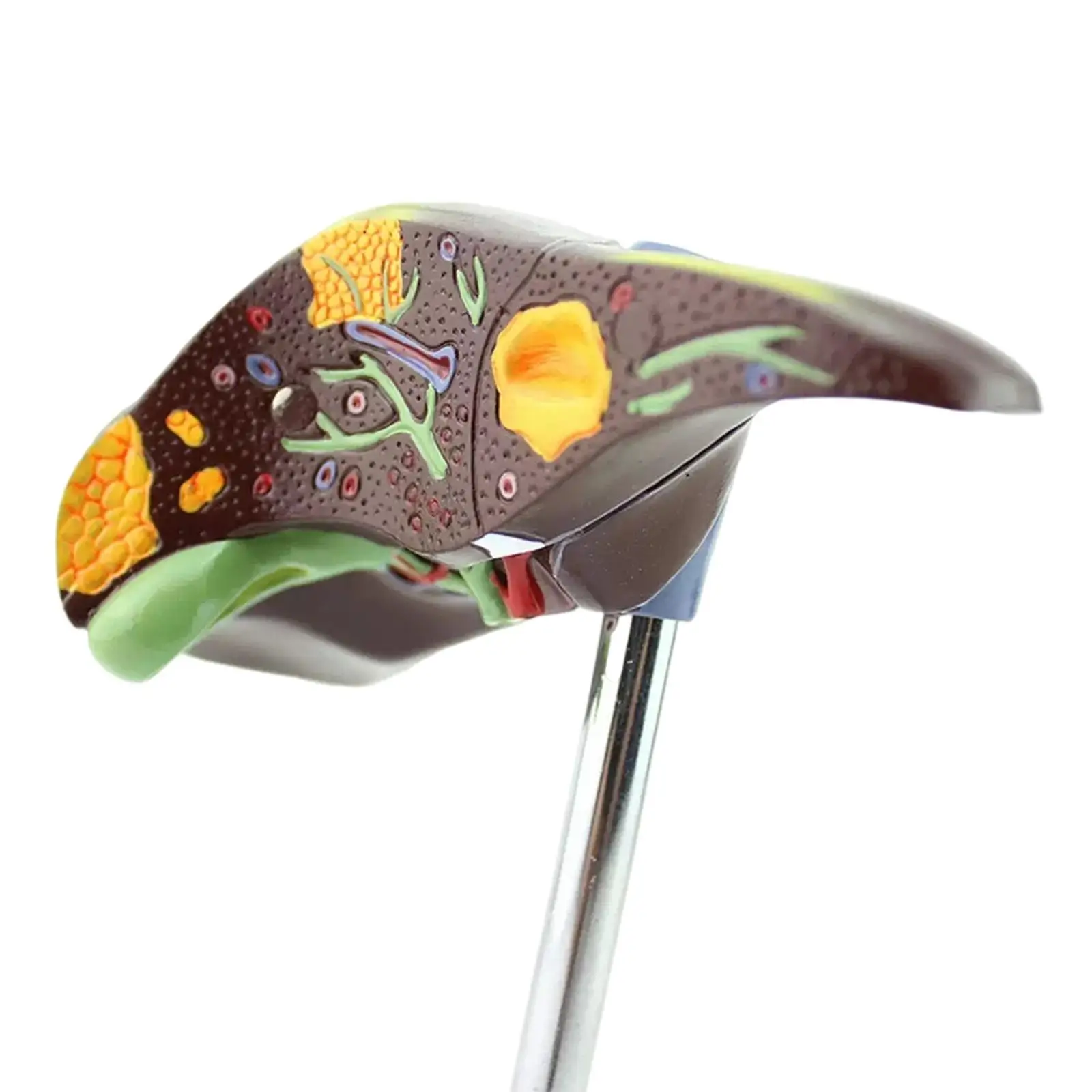 PVC Human Pathological Fatty Liver Cirrhosis Hepatitis Model Medical Teaching Models