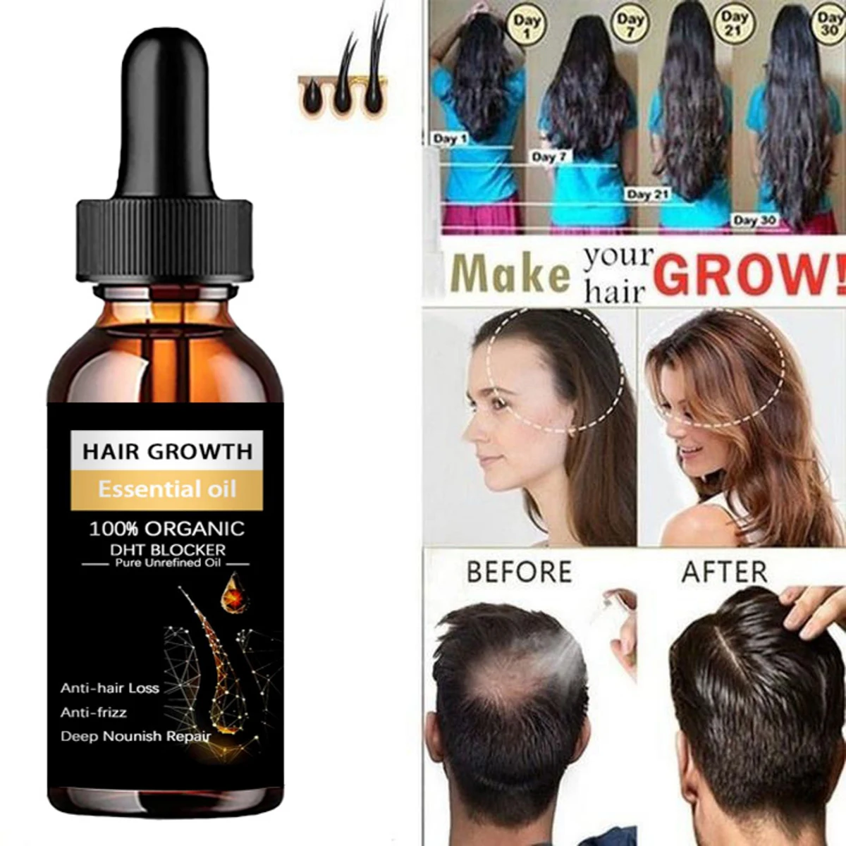 

Organic Hair Growth Essential Oils Products Fast Grow Anti Hair Loss Essence Prevent Hair Thinning Dry Frizzy Repair Serum