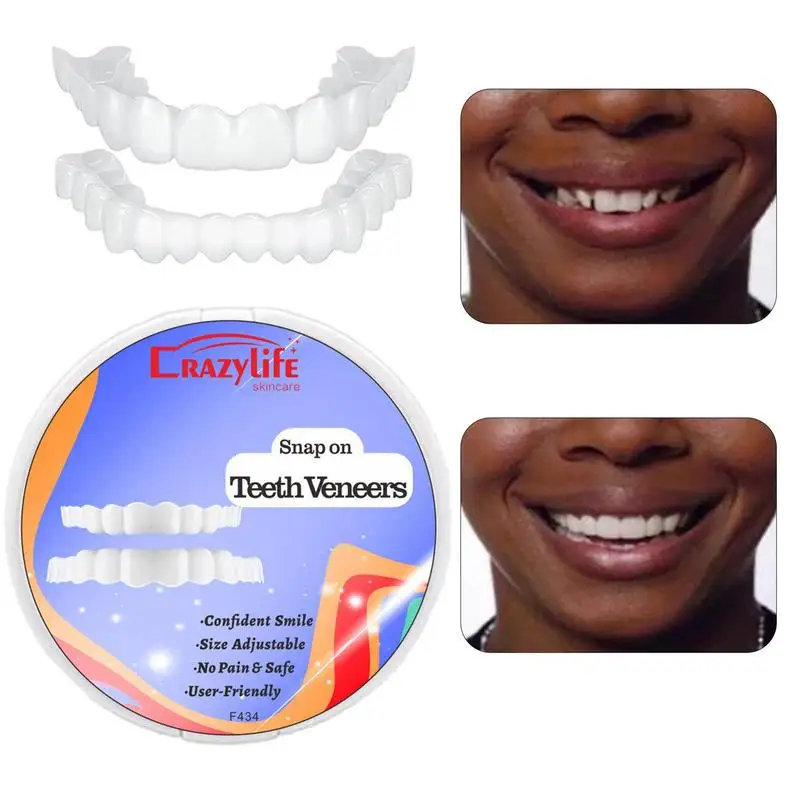 Snap On Teeth Veneers Cover The Imperfects Teeth Fake Tooth Instant Confidence Smile Temporary Teeth Teeth Beauty Tool Cosmetic