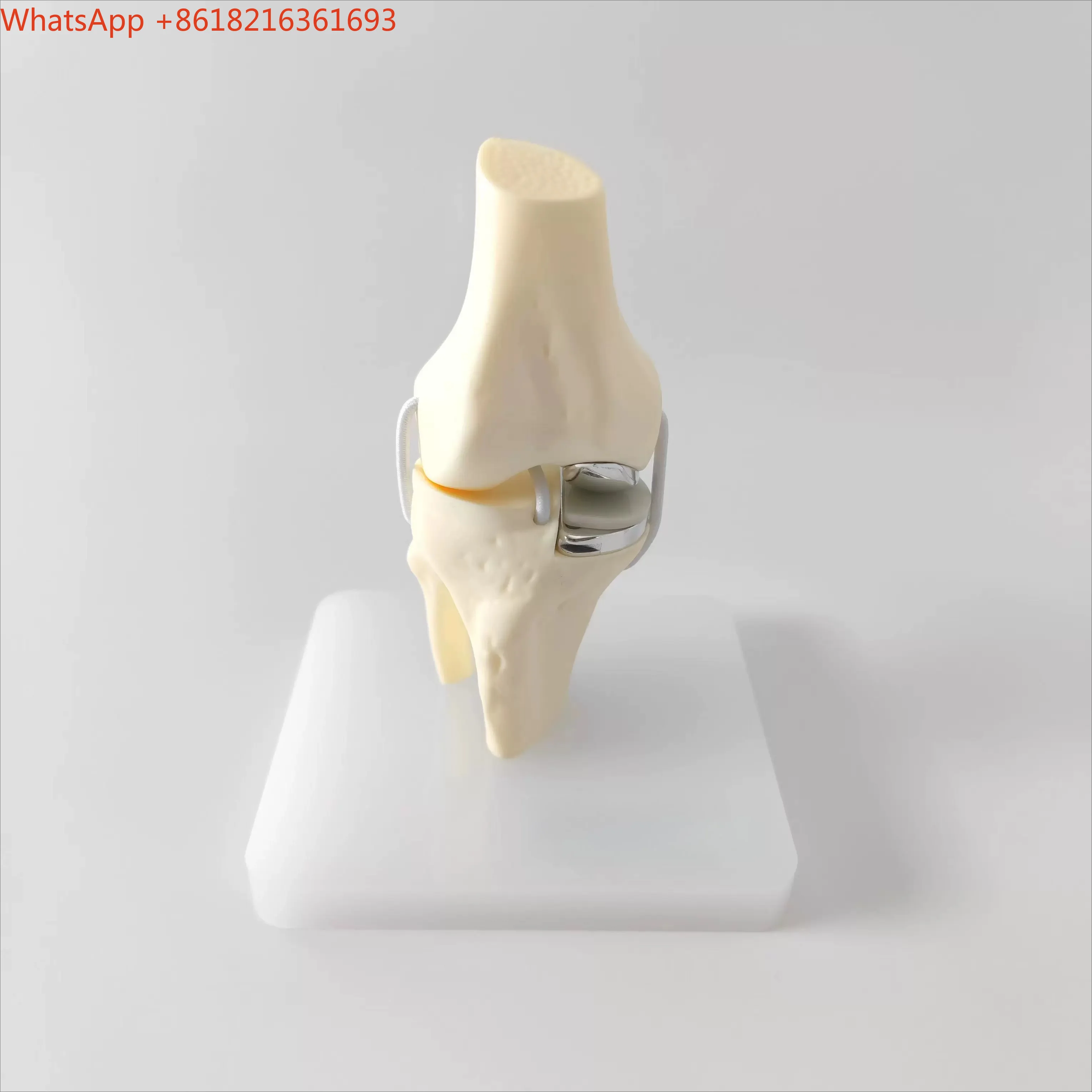 Limited Offer Unicondylar Knee, Total Knee Replacement Model, Communication Model Reduced Edition Accessories