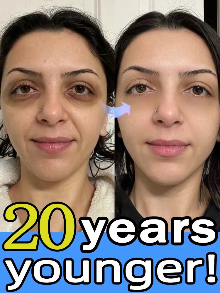 

Eye care cream that effectively removes eye bags