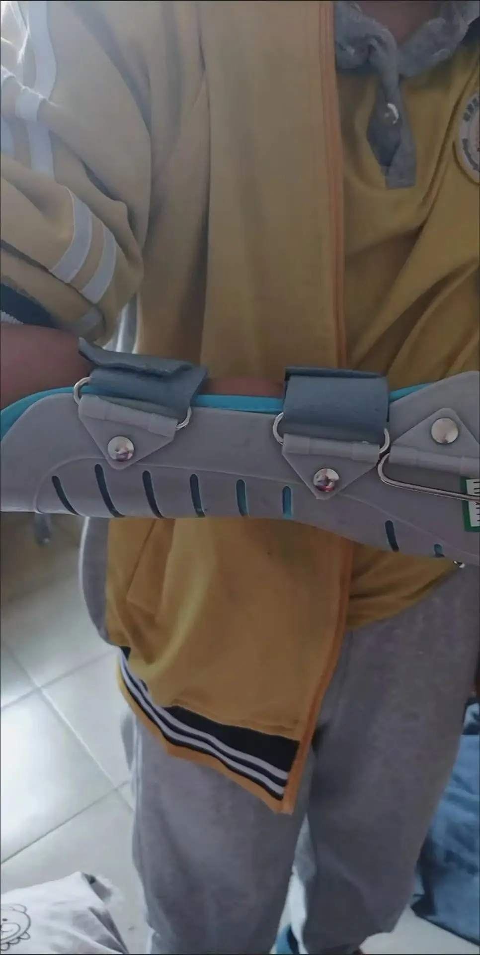 kid-carpal-tunnel-wrist-support-arm-brace-sling-hand-splint-breathable-adjustable-prevent-wrist-fracture-sprain-forearm-protecto