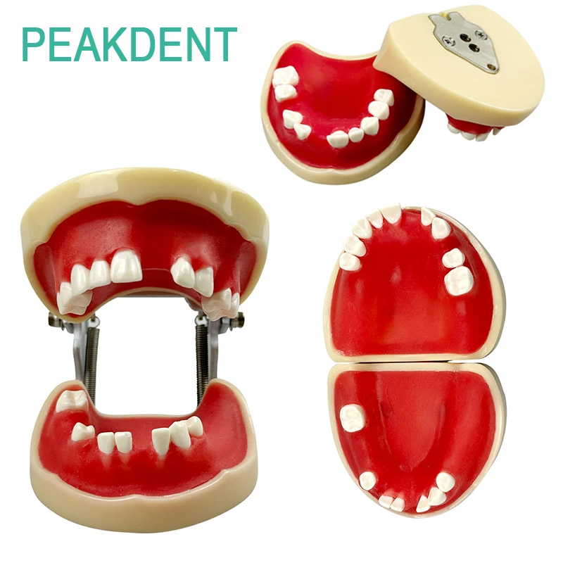نموذج زراعة الأسنان المفقودة للأسنان أبحاث الأسنان نموذج للتدريس تدريب طلاب الأسنان وضع التدريس #2