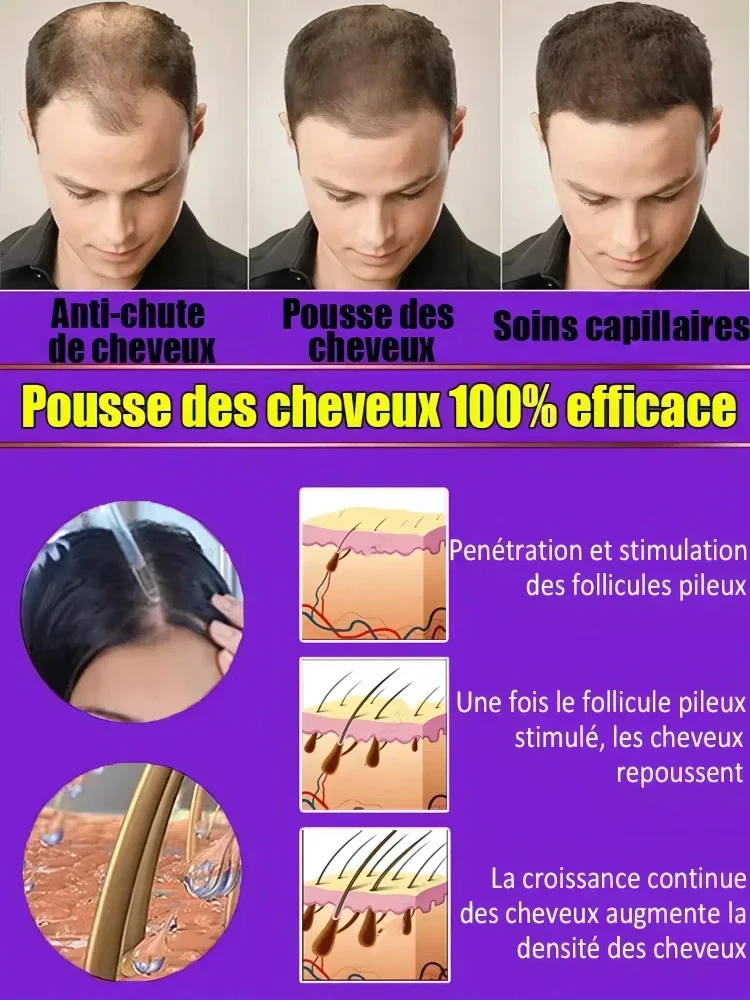 Herbal Hair Growth Enhancer