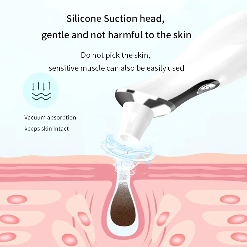 أداة إزالة الرؤوس السوداء الكهربائية البصرية لعلاج حب الشباب والبثور وإزالة الزيت والعناية الشخصية بالجمال أسود وأبيض سريع s
