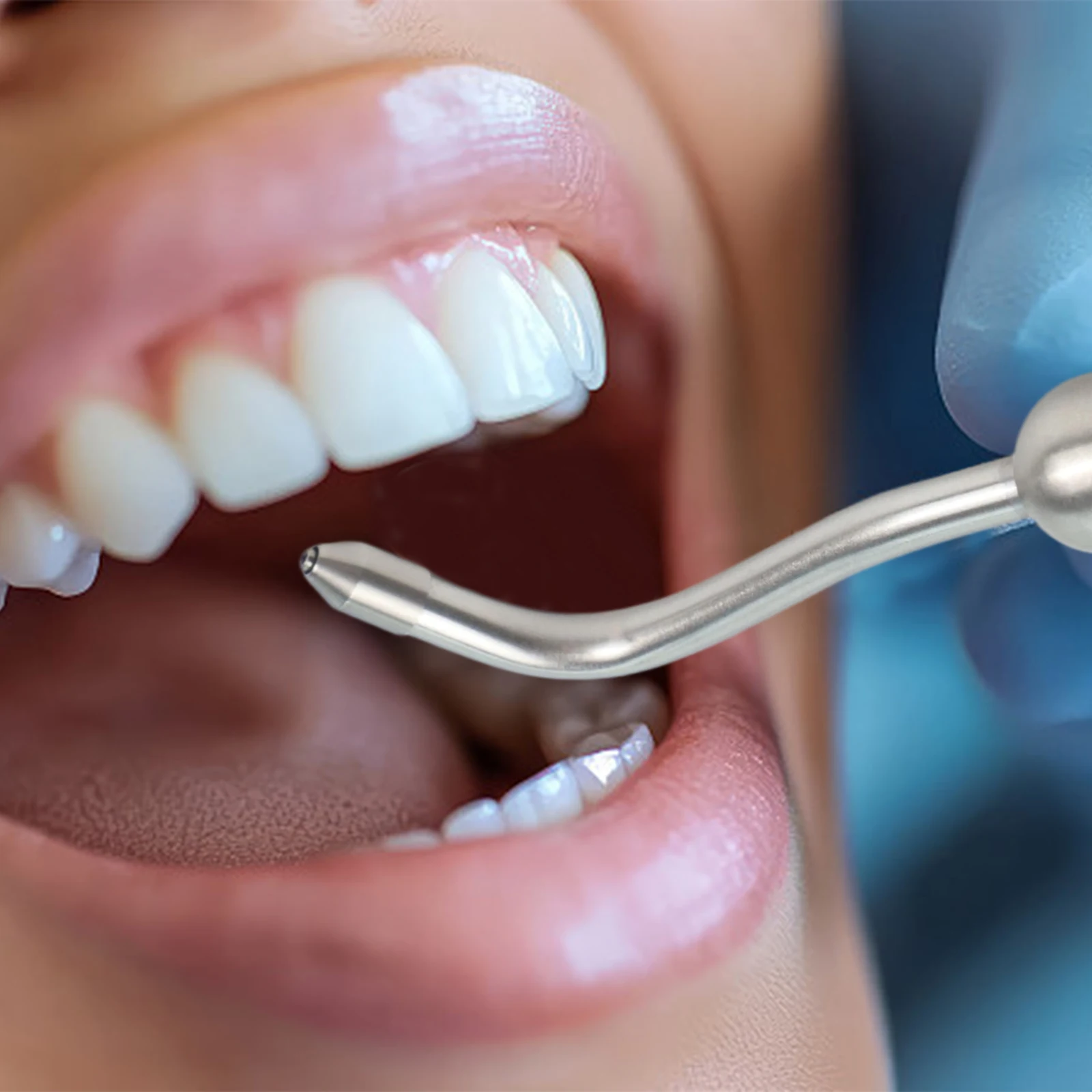 

Для N S K машина для чистки зубов, струйный рот, Dental Prophy, наконечник сопла 5 см, распылитель потока, специально предназначен для воздушной полировки