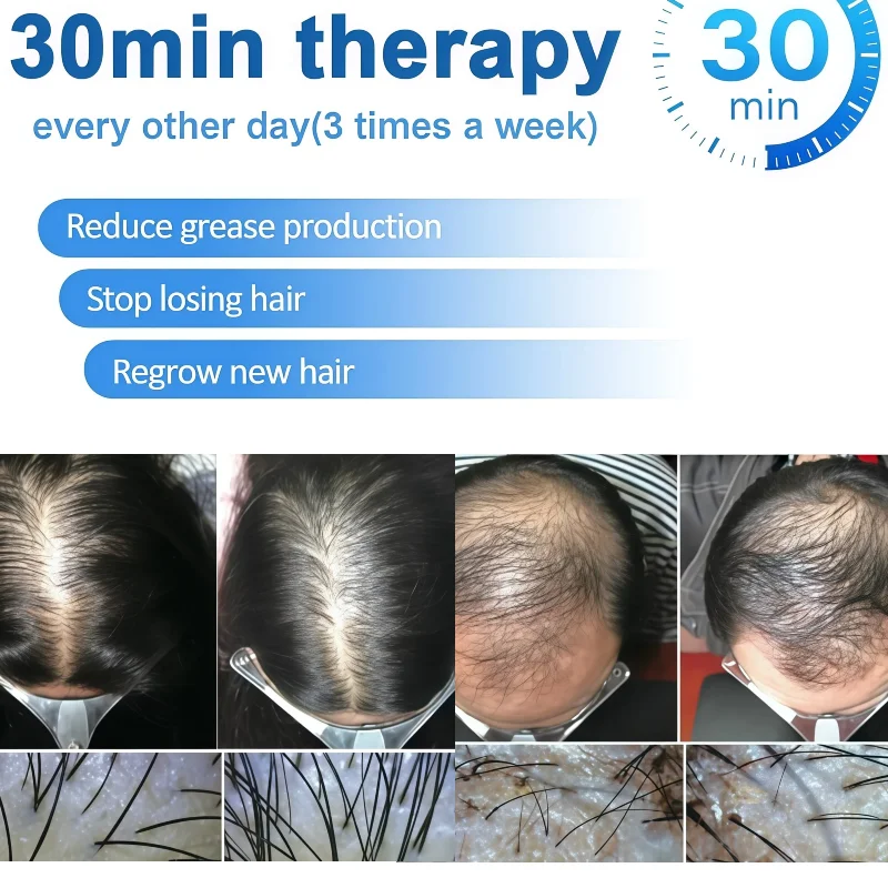 

650nm Red Light Therapy LLLT Laser Cap Hair Loss Treatment Helmet