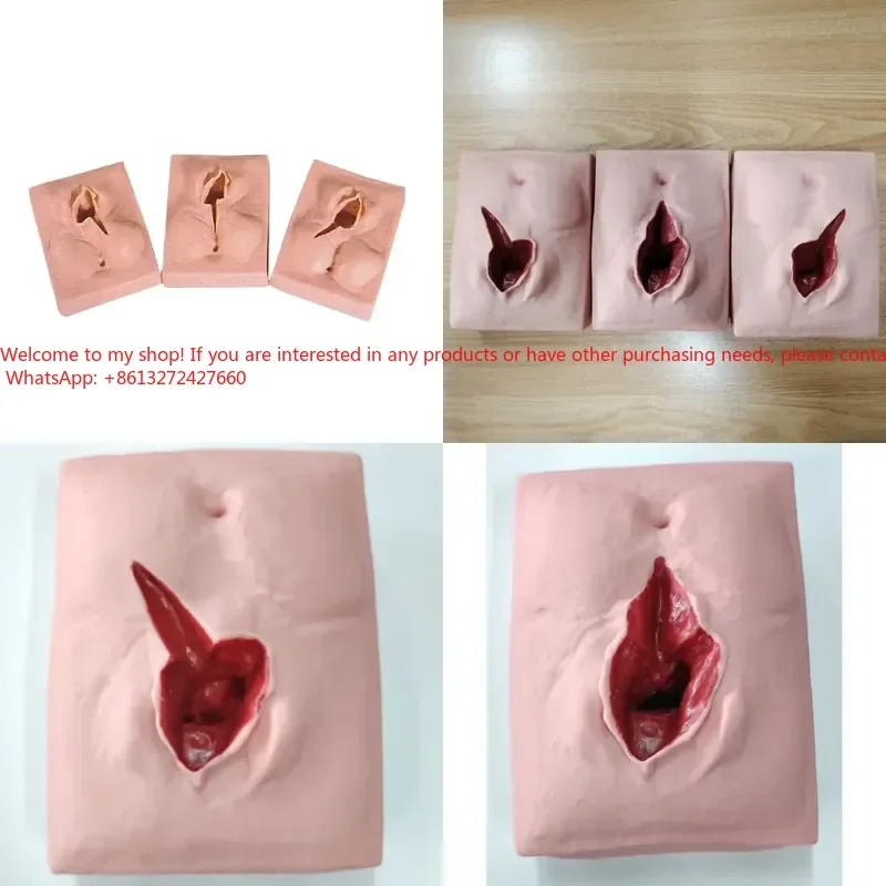 Medical Science Training Model for Obstetrics and Gynaecology Vulvar Suture Practice