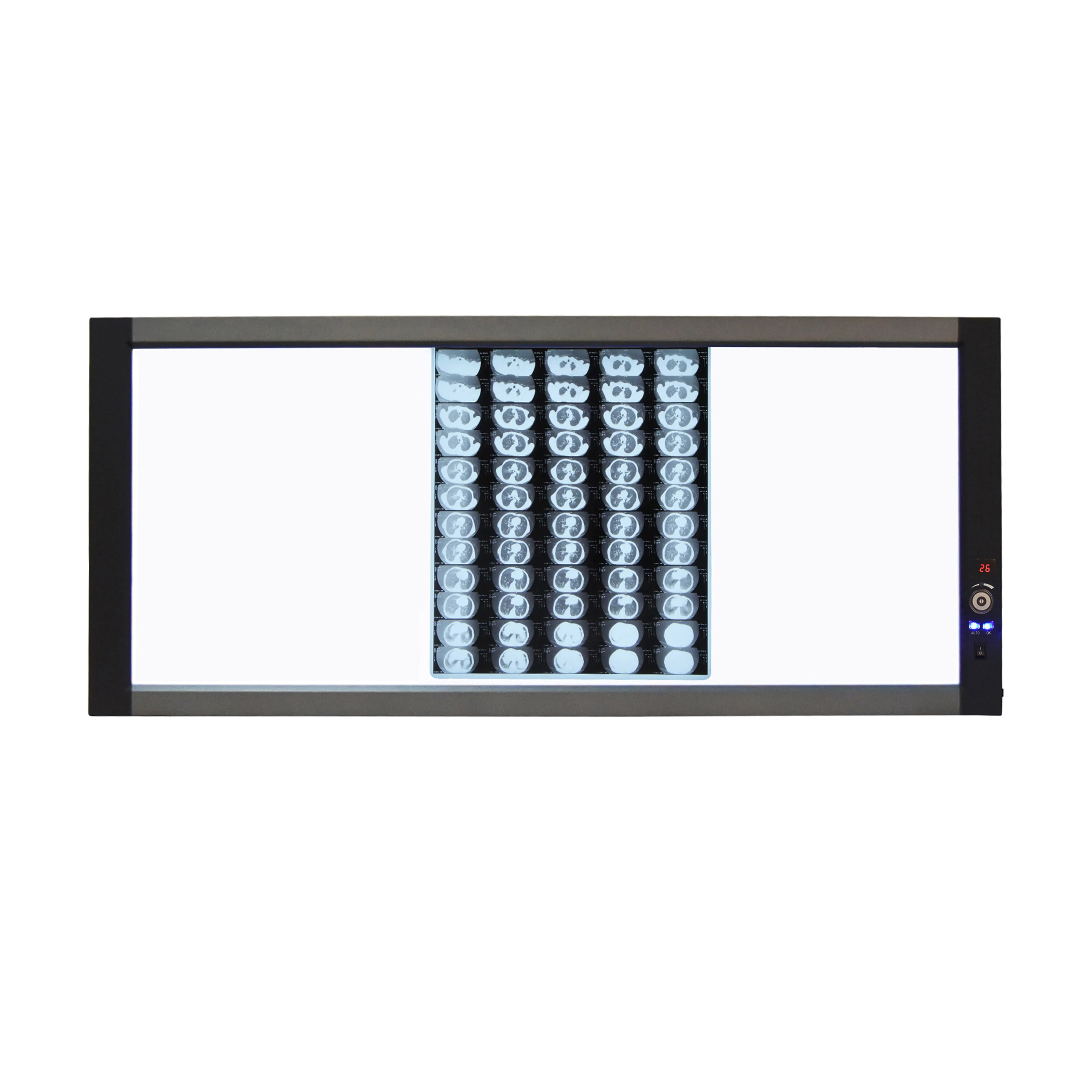 1196x500x25mm Triple Screen Medical Led X-ray Film Viewer Negatoscope