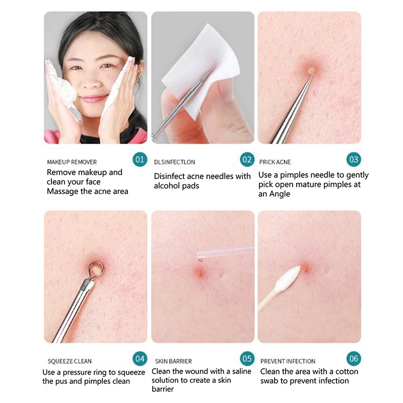 1pcs Cell Pimples Blackhead Stainless Steel Acne Needle Beauty Salon Special Scraping Closing Artifact Acne Needle Tool