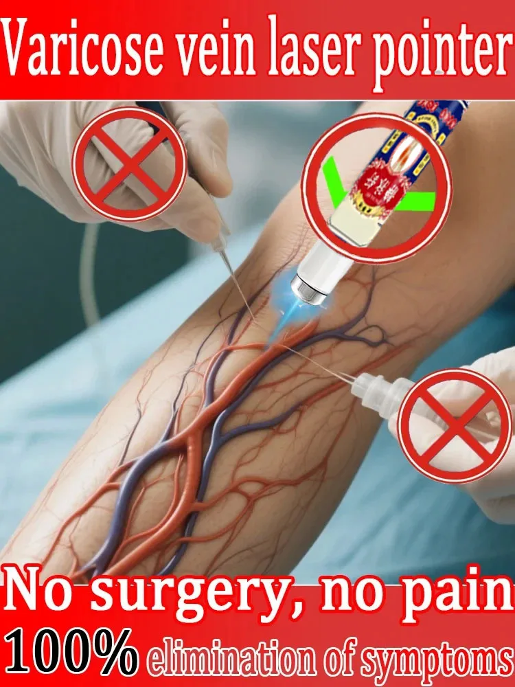 

Third generation varicose vein laser therapy pen: eliminates vasculitis and phlebitis, relieves spider leg pain device