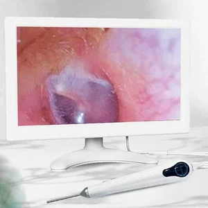 11 Main Sales Digital otoscope - №11