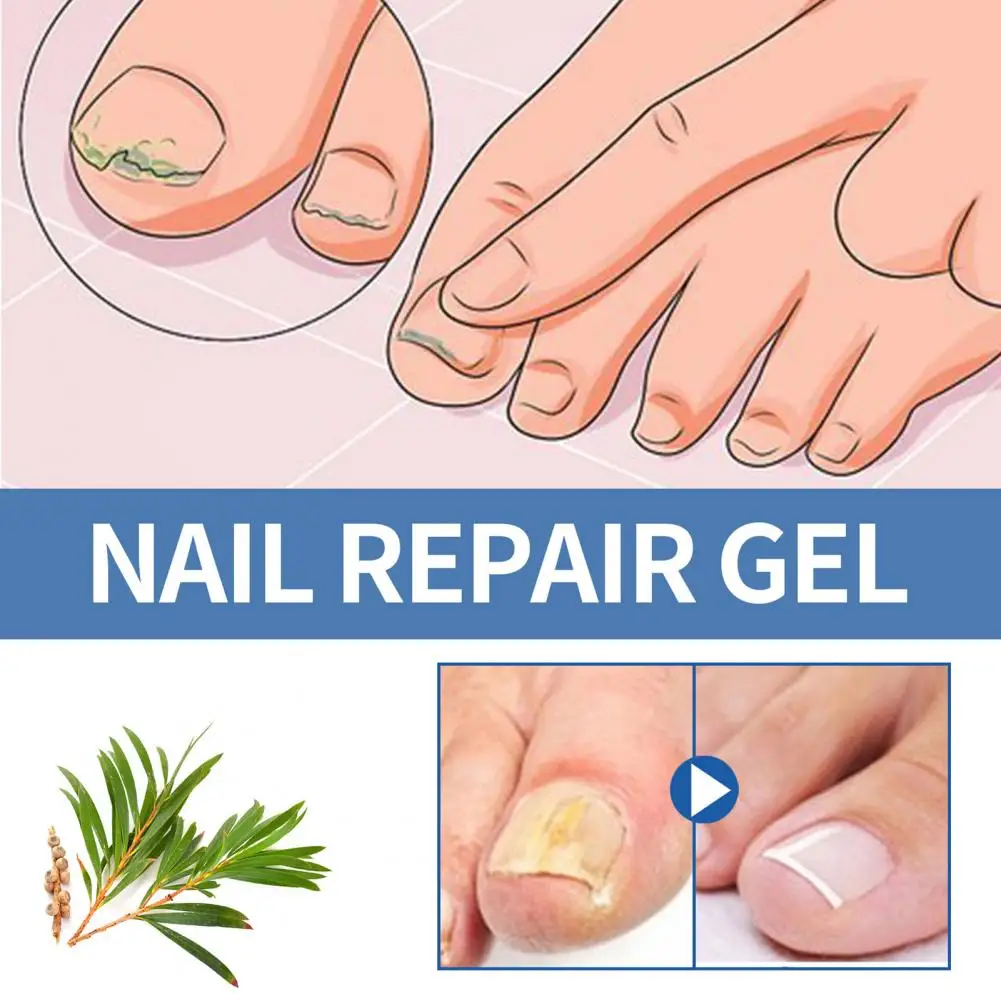 Nail Repair Gel Effective Nail Treatment Gel for Strengthening Repairing Beautifying Nails Long Lasting for Manicure