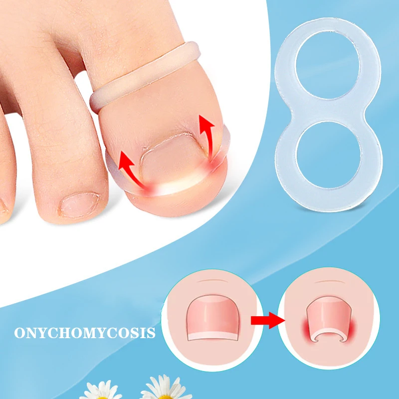 

Silicone Ingrown Toenail Correction Tool Invisible Ingrown Toenail Straightening Protector Brace Pedicure Foot Care Tools