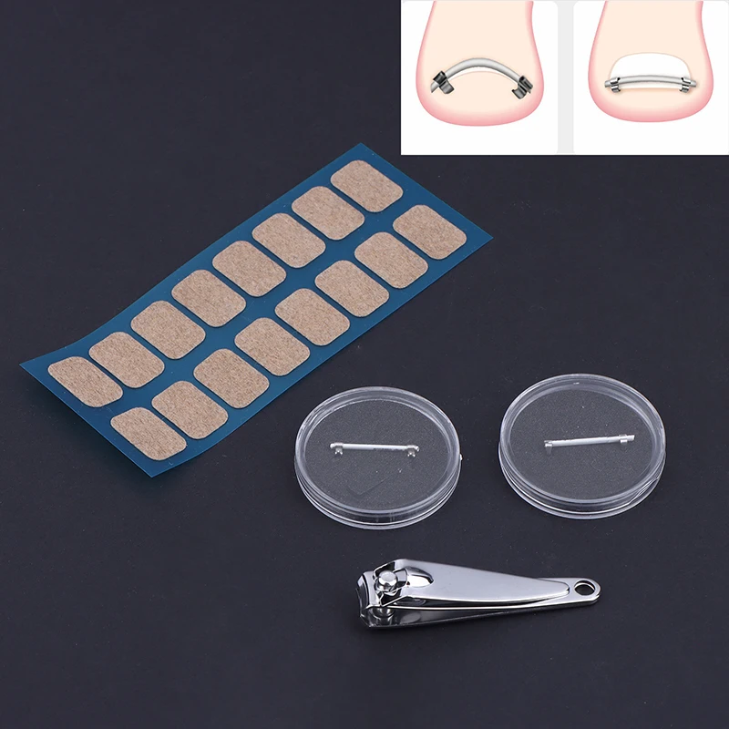 Zehen Eingewachsene Pediküre Nagel Schnalle Zehennägel Korrektor Fuß Nagel Korrektur Werkzeug Richt Clip Gebogene Klammer Korrektor