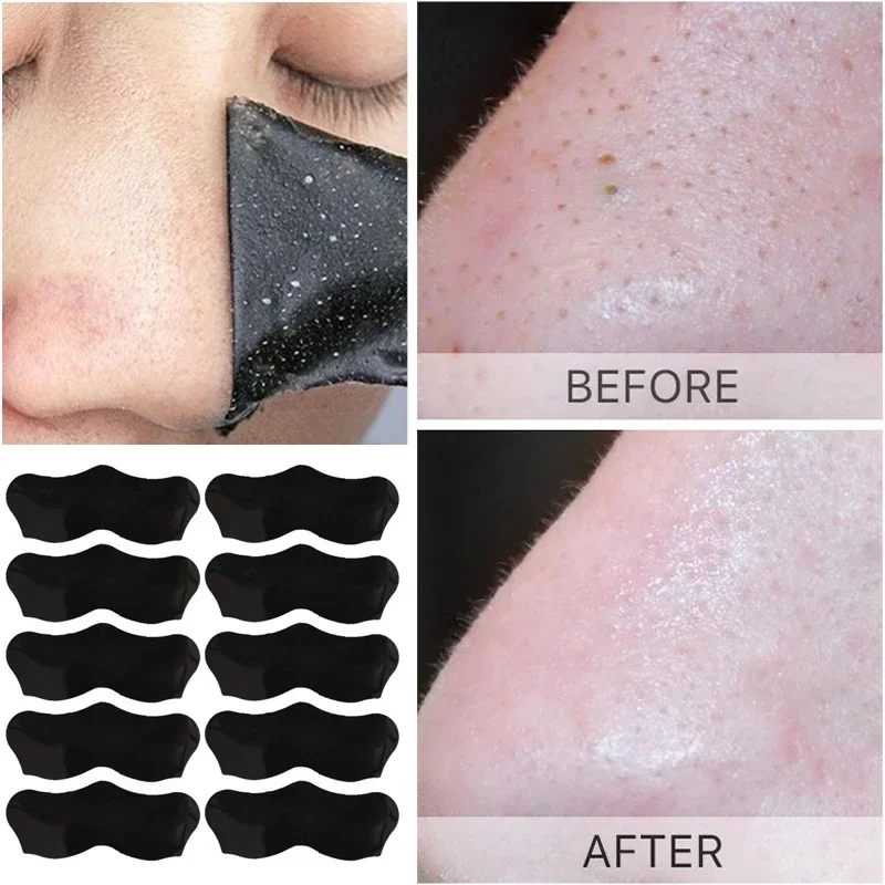 Nose Blackhead Remove Mask Set Shrink Pore Deep Cleansing Acne Treatment Black Head Remove Skin Care Strips Peel Off Mask