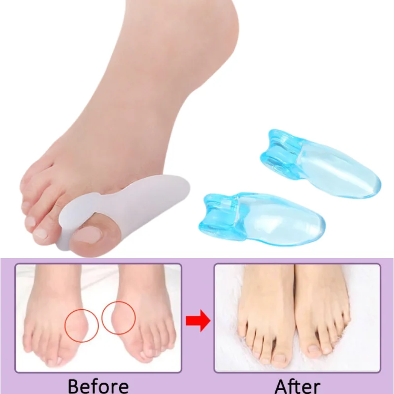 

100Pcs=50Pairs Silicone Gel Thumb Toe Corrector Bunion Foot Care Hallux Valgus Protector Separator Finger Straightener Adjuster