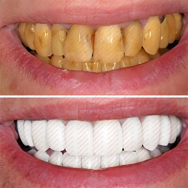 

Tooth Whitening Pen Dazzling White Teeth Whitening Pen Instant Teeth Whitening Pen Brighten Your Smile Tooth Hygiene Care Tools