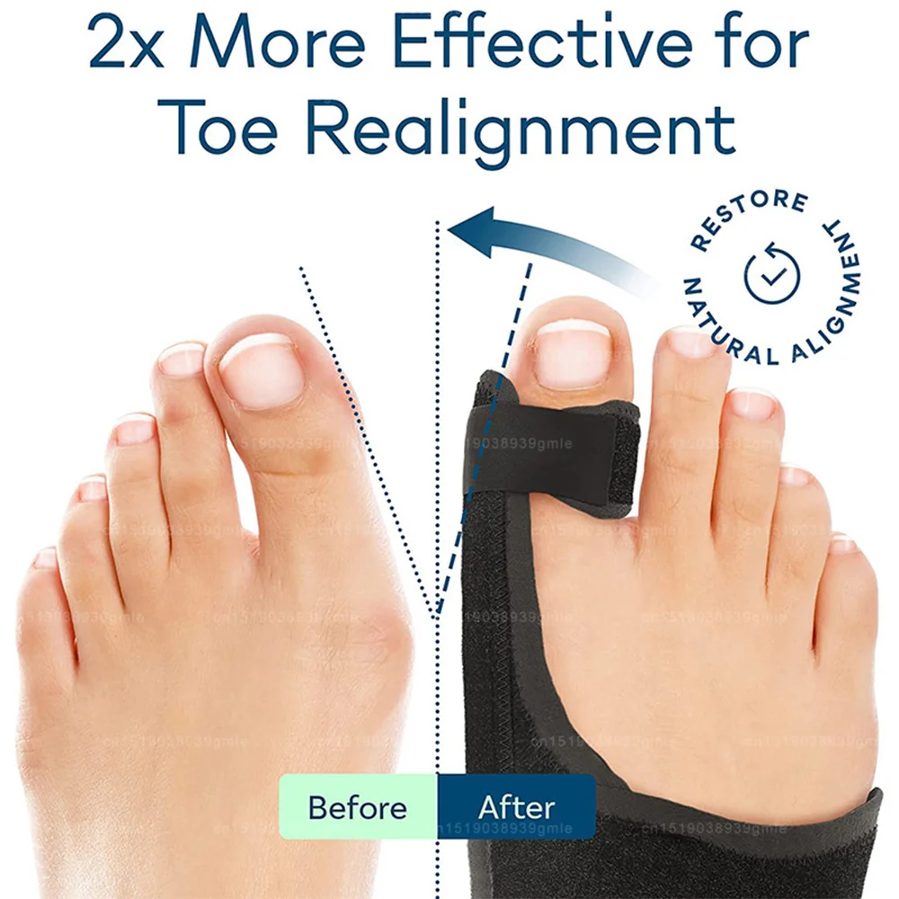 Foot Corrector Bunion Splint Hallux Valgus Correction Big Toe Straightener Orthopedic Corrector Pedicure Bunion Protector Toes