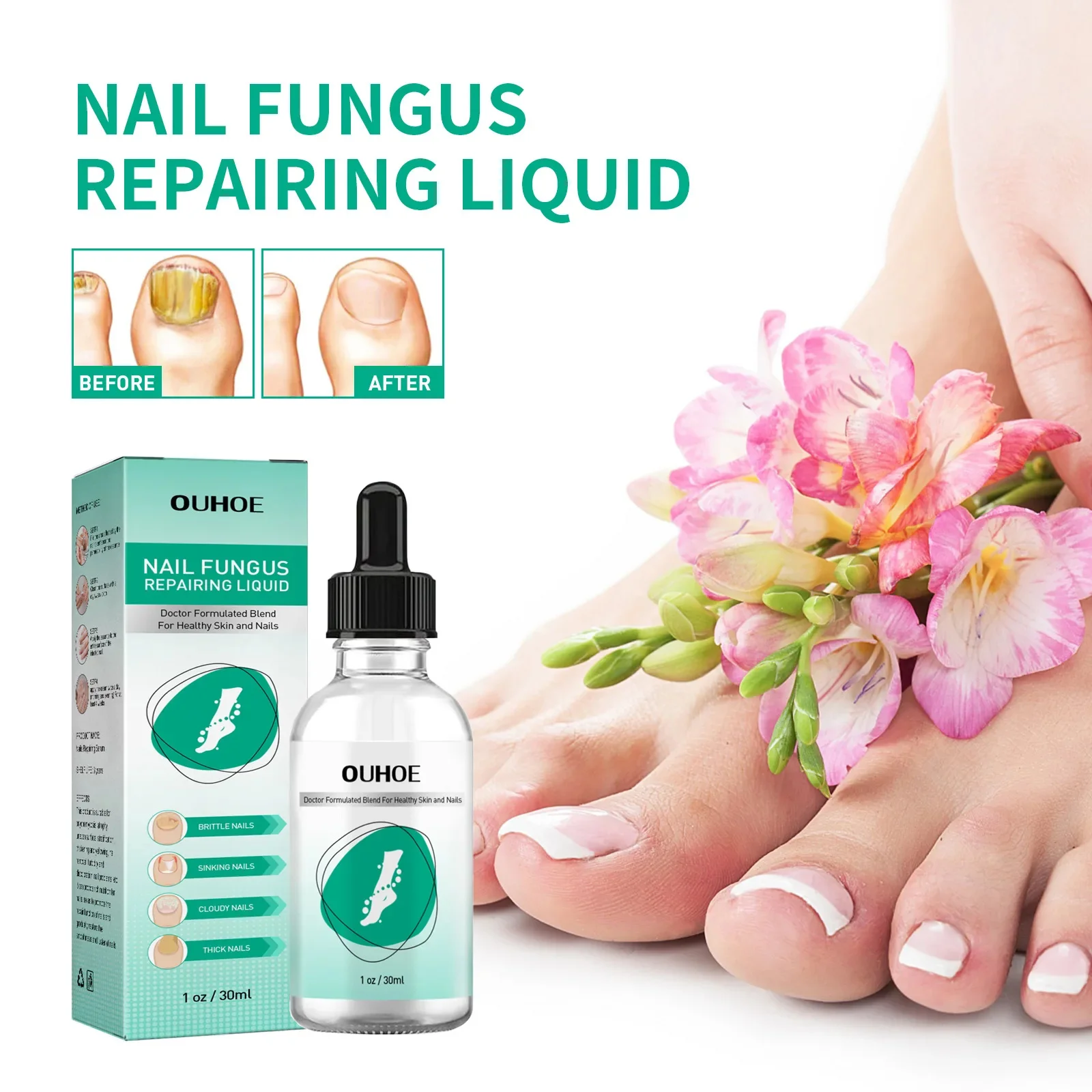 Nail Fungus Treatment Gel Herbal Nail Treatment Repairing Thickened Gray Nails Relieve Ingrown Nail Cleaning Anti Infection Care