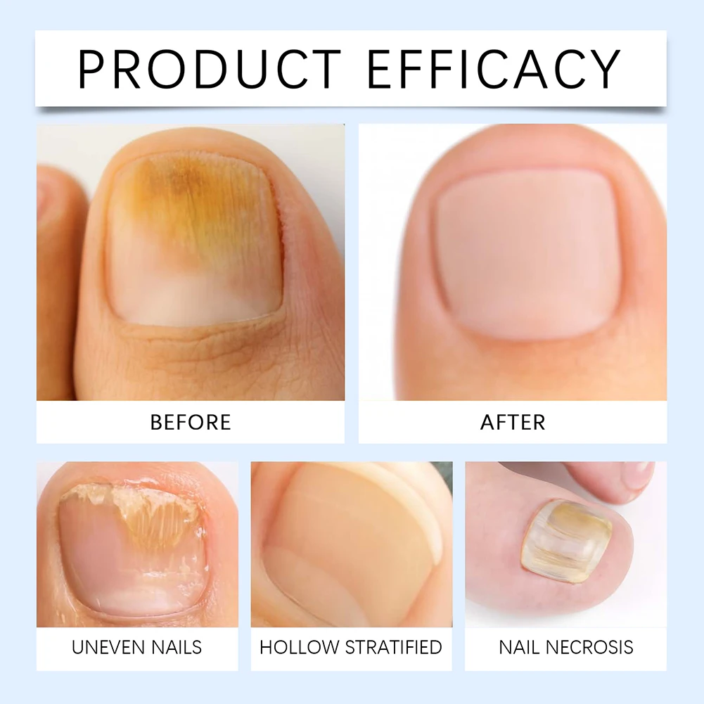 10 مللي علاجات إصلاح الأظافر المهنية مقوي الأظافر للأظافر الهشة العناية بالأظافر سائل ترطيب للنساء والرجال #6