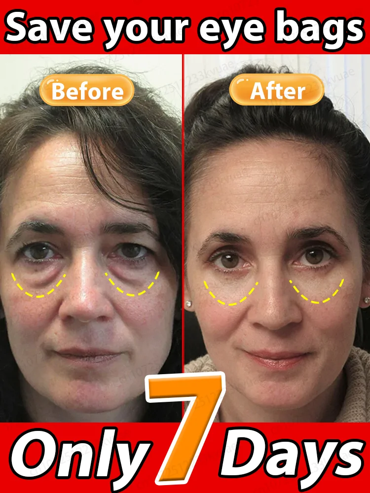 

Leading oral hygiene offerings Iɴsᴛᴀɴᴛʟʏ ʀᴇᴍᴏᴠᴇ ᴇʏᴇ ʙᴀɢs, ʀᴇᴅᴜᴄᴇ ғɪɴᴇ ʟɪɴᴇs, ᴛɪɢʜᴛᴇɴ sᴋɪɴ, ғɪɢʜᴛ ᴅᴀʀᴋ ᴄɪʀᴄʟᴇs, ᴀɴᴅ ʙʀɪɢʜᴛᴇɴ ᴇʏᴇs