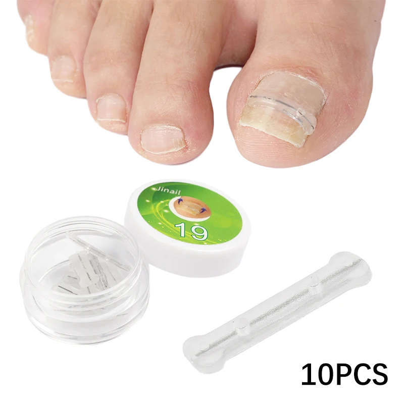 10 pçs 13-20mm adesivos de correção de unhas encravadas corretor de unhas remendos tratamento paroníquia recuperar corretor ferramentas de pedicure