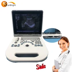 Full Digital Diagnostic Sonography Medical Portable Ultrasound Scanner