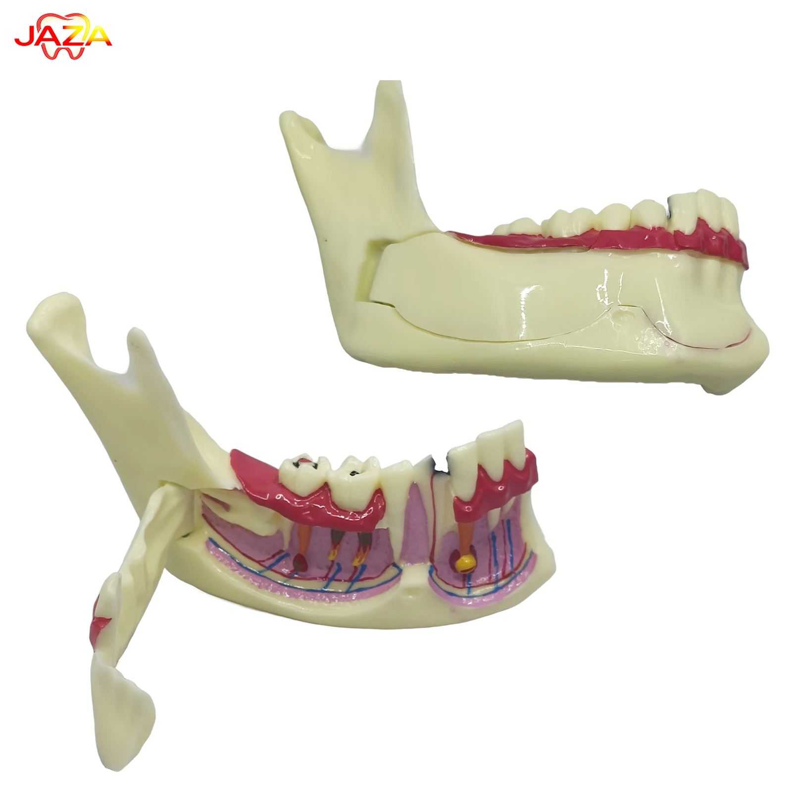 

Съемная модель нижней челюсти, с боковым открытым разрезом, для демонстрации заболеваний десны, кариеса и анатомии корня зуба, масштаб 1:1