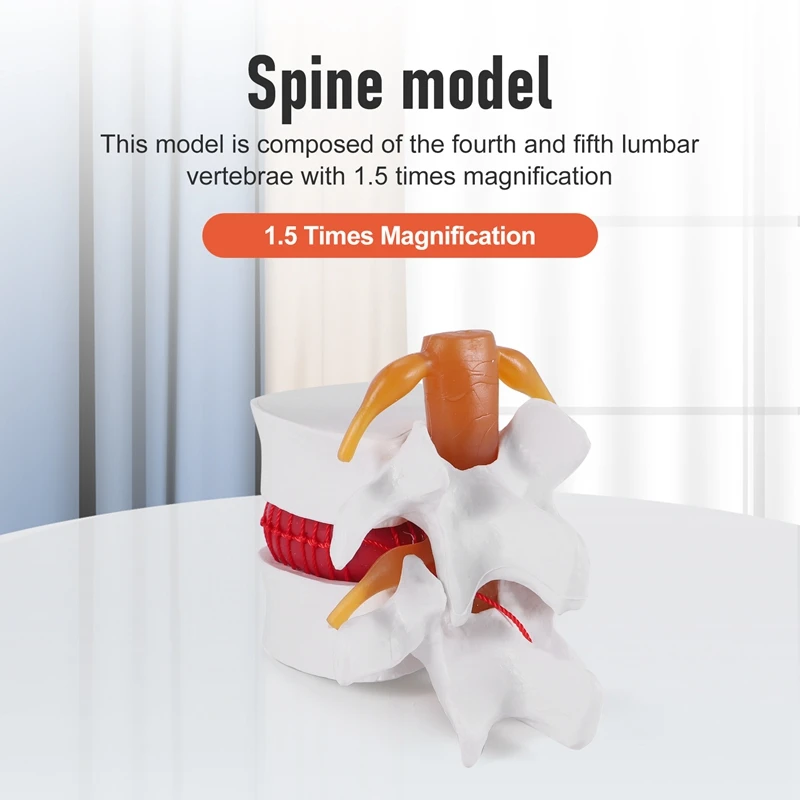 Top-1:1.5 Human Lumbar Disc Herniation Demonstration Model Of Lumbar Vertebral Spine Model For Human Anatomy