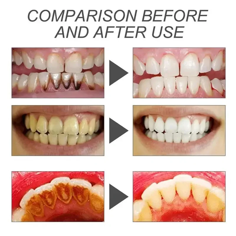 V34 Teeth Whitening Toothpaste Remove Plaque Stains Cleaning Oral Hygiene Bleaching Dental Tools Fresh Breath Dentistry Care