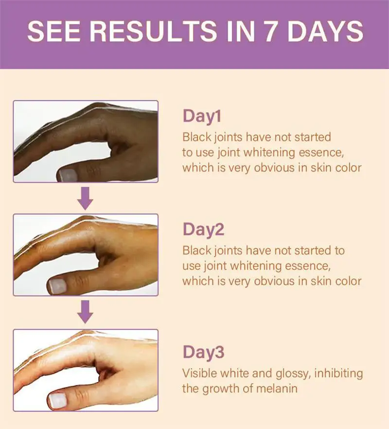 تبييض سريع المفاصل الداكنة سطع كريم اليد الميلانين مصحح ترطيب البقع المكثفة مزيل المنتجات العناية بالبشرة الكورية