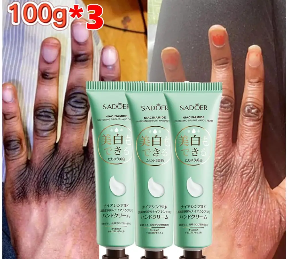 3X Brightening Dark Knuckles Cream Brighten Hand Cream Lighten Dull Corrector Moisturizing Stains Remover Products Korean Skin C