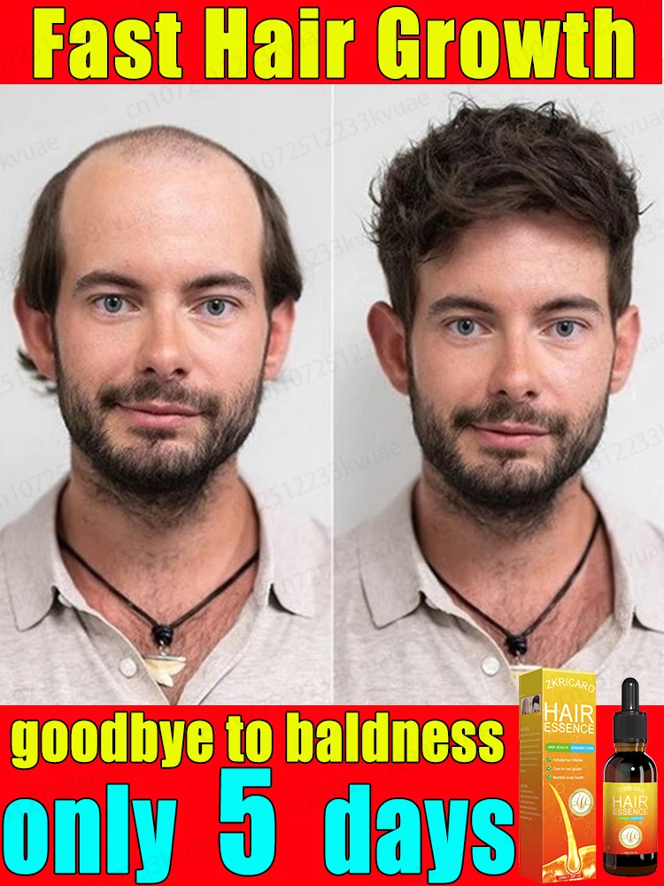 It only takes 7 days to repair baldness. Hair growth essential oil can effectively repair baldness.