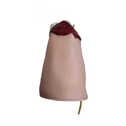 Medical hemostatic nursing model for lower limb trauma bleeding and thigh amputation