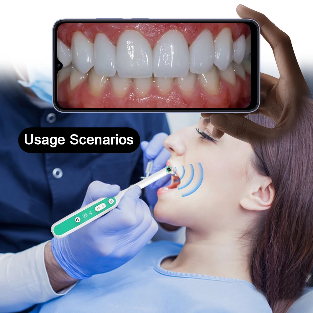 Câmera Intraoral Dental sem fio com Display HD, Wi-Fi, Dente Azul Conectando, Telefone Móvel, 8 LEDs Lâmpada