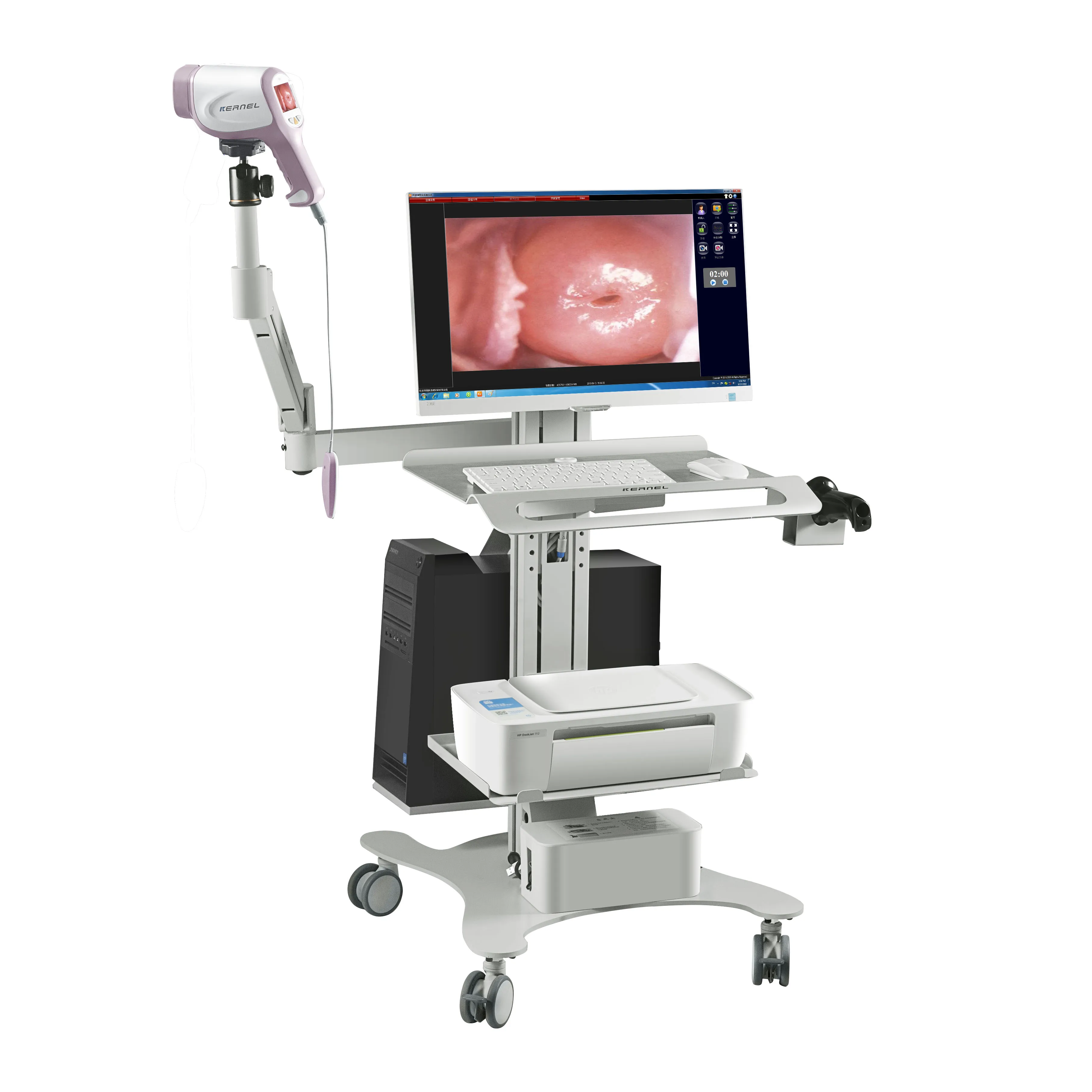 KN-2200I High Performance Trolley Design Digital Video Colposcope Video Colposcopio Digital Colposcope For Gynecology