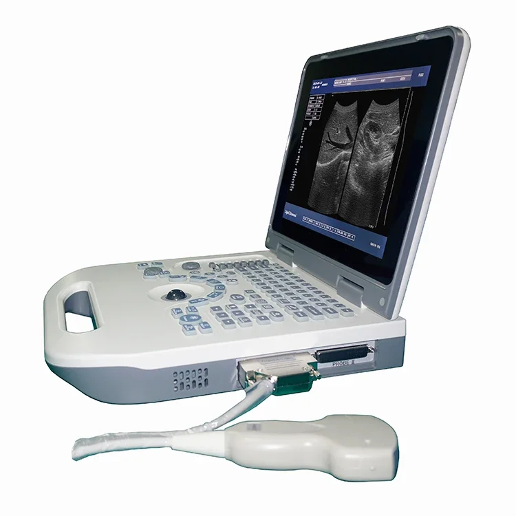 High Quality Expert  Full Digital Laptop Ultrasound Portable Ultrasound Machine Price