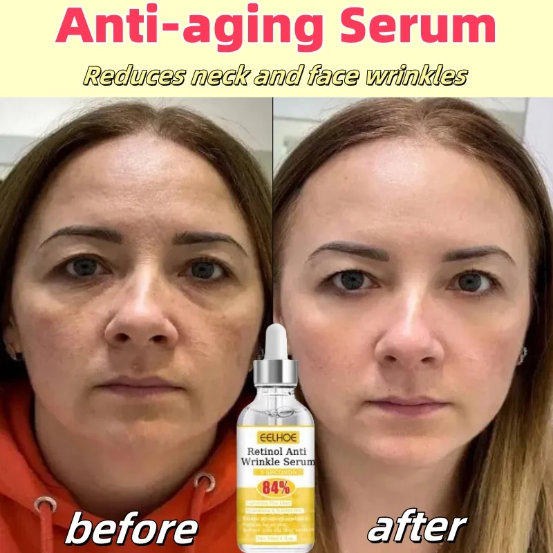 

Anti-aging Serum Wrinkle Remover Reduce Neck Face Lines Anti Age Collagen Boost Skin Moisturizing Care Products For Women