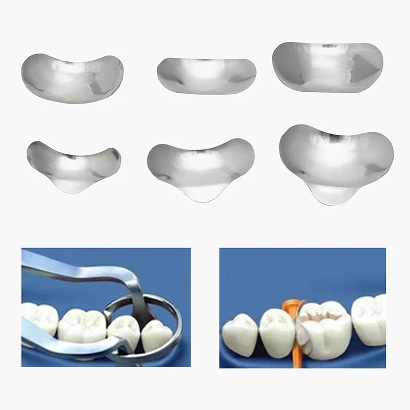 100pcs/set Dental Matrix Dental Sectional Contoured Matrices Matrix Ring Delta Wedges Filling Metal Matrices Bands