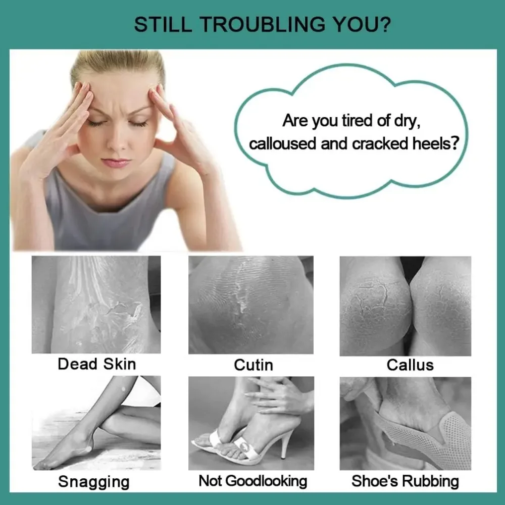 4 in 1 Strumento per pedicure Spazzola per piedi Spazzola per piedi Lima per piedi Rimozione calli con raspa per piedi Pietra pomice Lima per pelle morta Strumento per la cura dei piedi