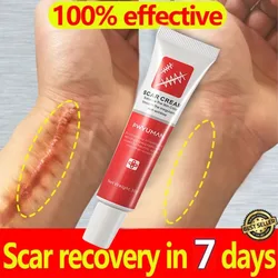 Fast Scar Removal Cream Treatment Stretch Marks Burn Surgical Scar Acne Spots Repair Gel Whitening Moisturizing Smooth Skin Care