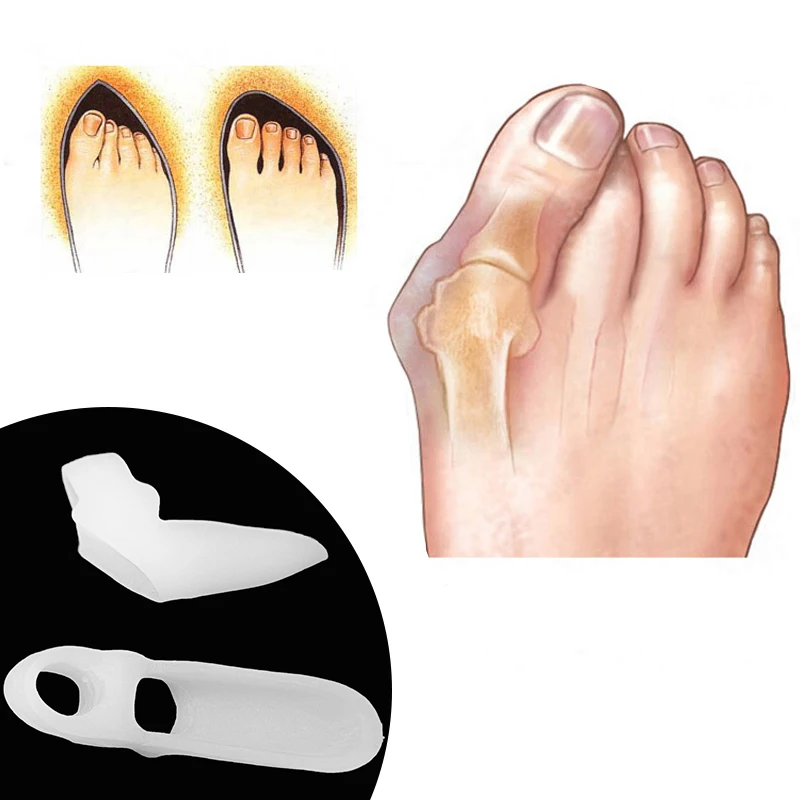 2 pares/lote dedo do pé separador alisador corretor de dedo do pé alívio hálux valgus correção osso polegar ferramentas cuidados com os pés