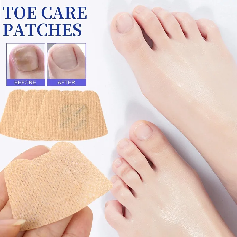 100pcs Fungal Nail Patches Toenail Fungus Treatment Extra Strength – Overnight Nail Care Repair for Damaged Discolored Nails