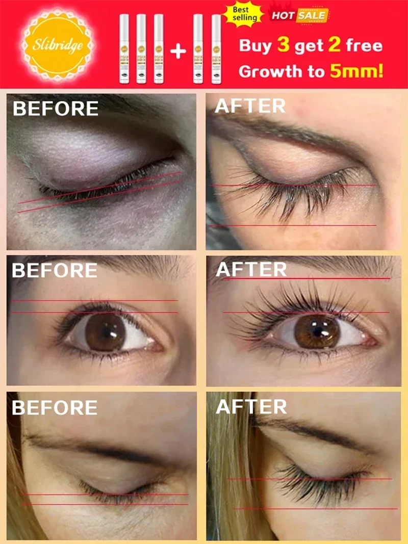 28 Days Fast Eyelash Growth Serum Natural Eyelashes Enhancer Longer Thicker Eyebrows Lift Eye Care Fuller Lashes Products