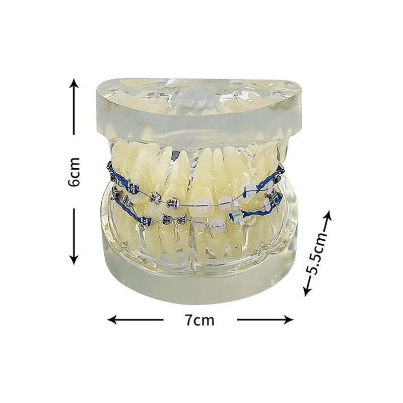 Orthodontic Treatment Model Dental Typodont Teeth Demonstration Model With Braces Brackets Chain Ties Arch Wire Dentistry Model