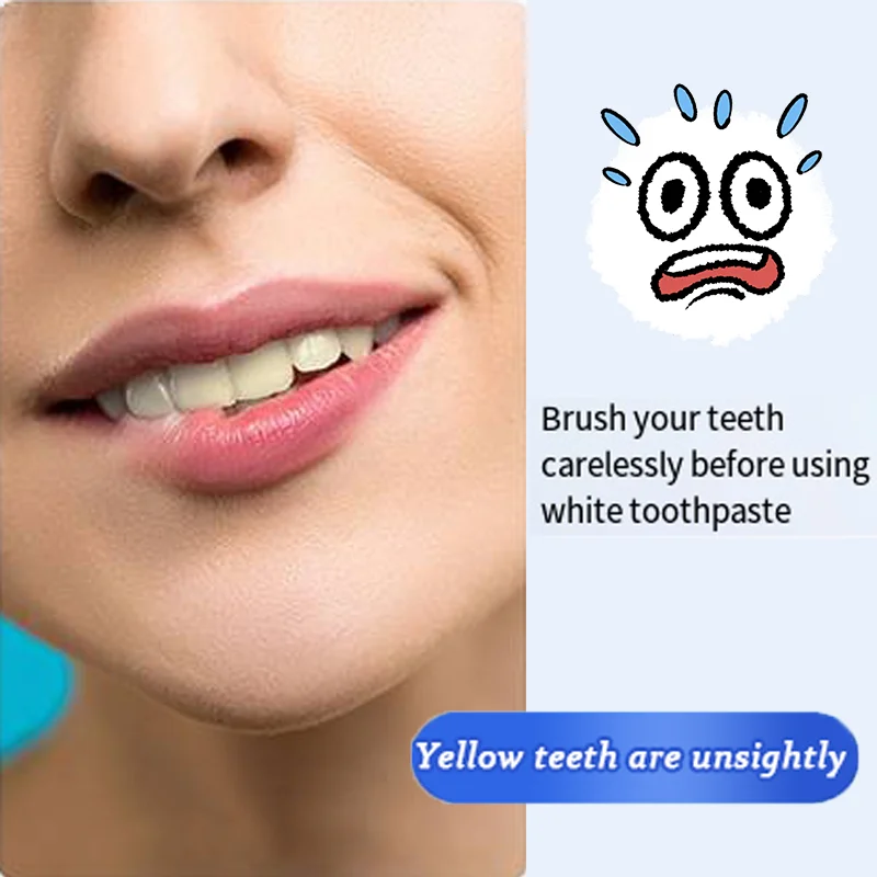 3ND Quick Teeth Whitening Repair for Cavities Caries Plaque Decay Removal - Stains Yellowing Teeth Whitening Solution