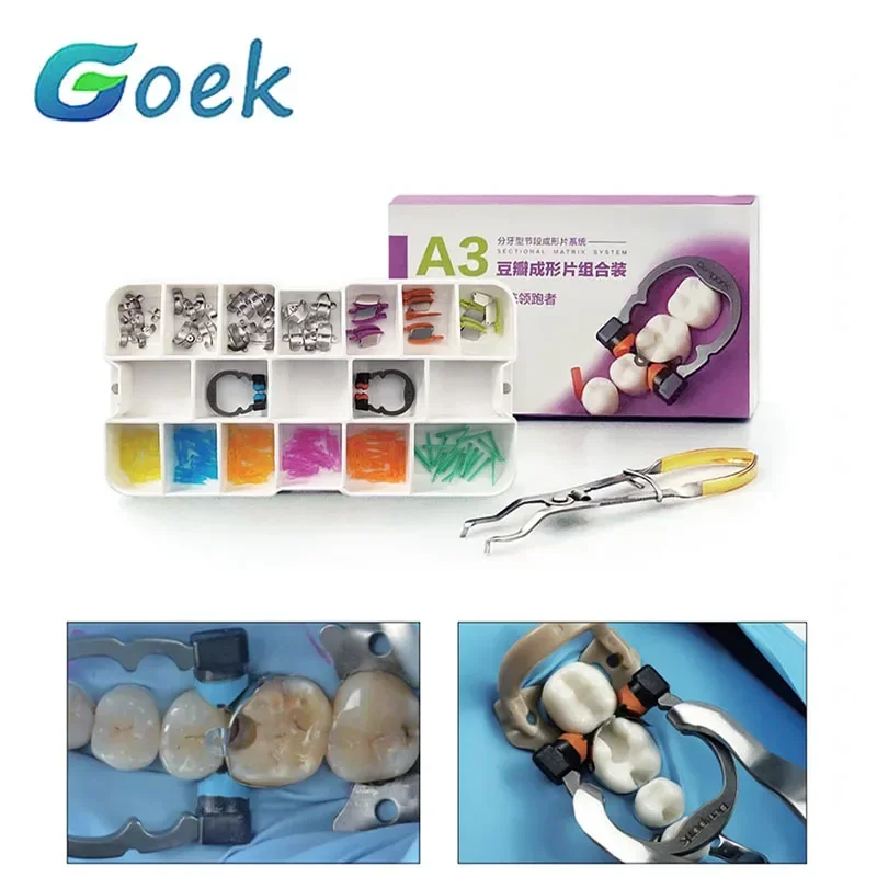 Dental segmentowy system matrycowy A3 segmentowe opaski matrycowe M4 diamentowe kliny nikiel tytanowe pierścienie ortodontyczne akcesoria