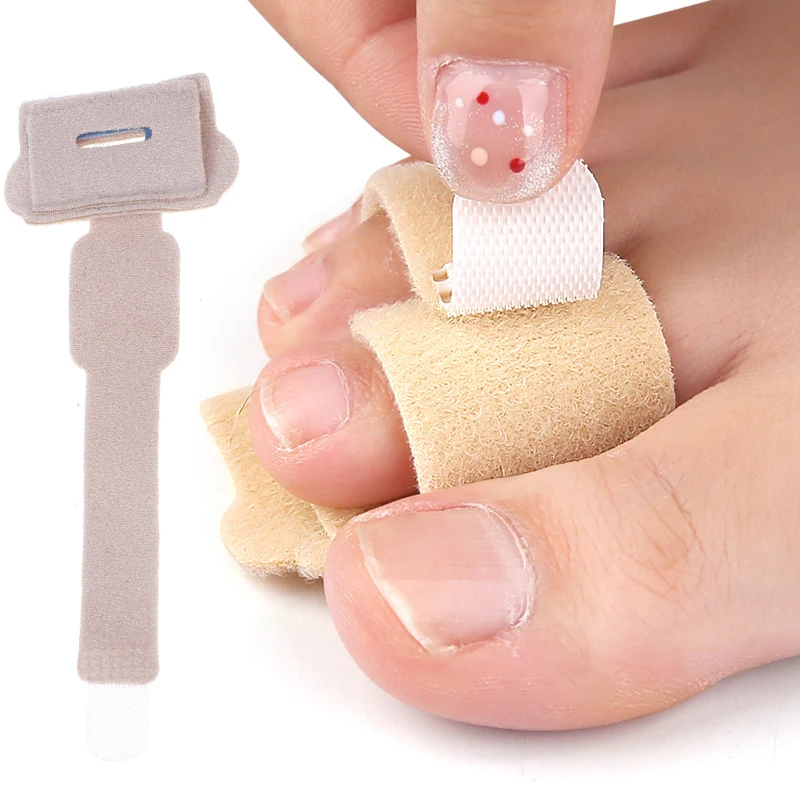 Toe Straightener Breathable Bunion Corrector ไม่เปลี่ยนรูปรองเท้านิ้วมือ Straightener Hammer Toe Hallux Valgus Corrector