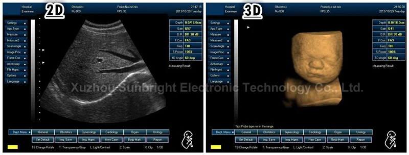 Cheap But Better Than Dp 10 Laptop 3D Color Ultrasound Portable Ultrasound Machine Echo Doppler Sun-800D